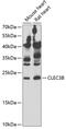 C-Type Lectin Domain Family 3 Member B antibody, 22-205, ProSci, Western Blot image 