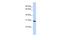 Survival Motor Neuron Domain Containing 1 antibody, A08419-1, Boster Biological Technology, Western Blot image 