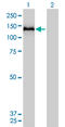 Collagen Type VI Alpha 2 Chain antibody, LS-B11119, Lifespan Biosciences, Western Blot image 