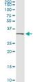 Annexin A5 antibody, H00000308-M01, Novus Biologicals, Immunoprecipitation image 