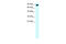 Apolipoprotein B MRNA Editing Enzyme Catalytic Subunit 3G antibody, 27-432, ProSci, Western Blot image 