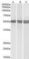DEAD-Box Helicase 6 antibody, GTX89391, GeneTex, Western Blot image 