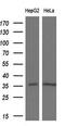 Pyrroline-5-Carboxylate Reductase 2 antibody, M10327, Boster Biological Technology, Western Blot image 