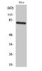 Tumor Protein P73 antibody, A00688Y99-1, Boster Biological Technology, Western Blot image 