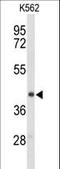 Ectonucleoside triphosphate diphosphohydrolase 2 antibody, LS-C167774, Lifespan Biosciences, Western Blot image 