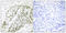 Activating Transcription Factor 2 antibody, LS-C198650, Lifespan Biosciences, Immunohistochemistry paraffin image 