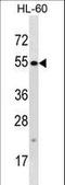 Tetratricopeptide Repeat Domain 34 antibody, LS-C203710, Lifespan Biosciences, Western Blot image 