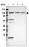 Integrator Complex Subunit 6 antibody, PA5-51643, Invitrogen Antibodies, Western Blot image 