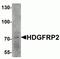 HDGF Like 2 antibody, NBP2-81994, Novus Biologicals, Western Blot image 