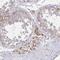 Transmembrane Protein 219 antibody, NBP2-32439, Novus Biologicals, Immunohistochemistry paraffin image 