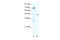 Nuclear Receptor Subfamily 2 Group F Member 6 antibody, ARP32995_T100, Aviva Systems Biology, Western Blot image 