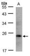 Growth Hormone 1 antibody, GTX101220, GeneTex, Western Blot image 