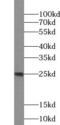 Interleukin 11 antibody, FNab04216, FineTest, Western Blot image 