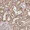 Metastasis-associated in colon cancer protein 1 antibody, PA5-56163, Invitrogen Antibodies, Immunohistochemistry frozen image 