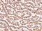 Serpin Family D Member 1 antibody, GTX02078, GeneTex, Immunohistochemistry paraffin image 