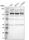 Apoptotic chromatin condensation inducer in the nucleus antibody, HPA000657, Atlas Antibodies, Western Blot image 