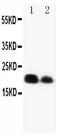 IL-6 antibody, PA1352, Boster Biological Technology, Western Blot image 