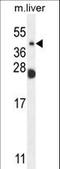 Neuraminidase 4 antibody, LS-C164834, Lifespan Biosciences, Western Blot image 