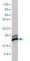 Chromobox 3 antibody, H00011335-M01, Novus Biologicals, Western Blot image 