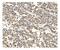 Phosphatidylinositol-4,5-Bisphosphate 3-Kinase Catalytic Subunit Gamma antibody, A01517-2, Boster Biological Technology, Immunohistochemistry paraffin image 