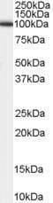 ADAM Metallopeptidase Domain 17 antibody, PA1-31074, Invitrogen Antibodies, Western Blot image 