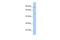 Zinc Finger Protein 585B antibody, A13968, Boster Biological Technology, Western Blot image 