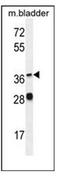 Fatty Acid Desaturase 6 antibody, AP51508PU-N, Origene, Western Blot image 