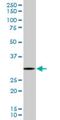 Ribosomal Protein S3 antibody, H00006188-M03, Novus Biologicals, Western Blot image 