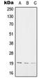 Sorting Nexin 3 antibody, LS-C353087, Lifespan Biosciences, Western Blot image 