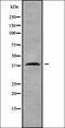 Calcitonin Receptor Like Receptor antibody, orb336388, Biorbyt, Western Blot image 