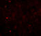 Translocase Of Outer Mitochondrial Membrane 70 antibody, 4959, ProSci, Immunofluorescence image 