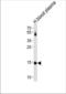 Transthyretin antibody, TA324860, Origene, Western Blot image 