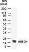 Ubiquitin Conjugating Enzyme E2 N antibody, PA1-41188, Invitrogen Antibodies, Western Blot image 