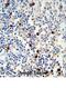 Immunoglobulin Lambda Variable 1-51 antibody, abx034778, Abbexa, Immunohistochemistry frozen image 
