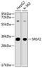 Serine And Arginine Rich Splicing Factor 2 antibody, 14-549, ProSci, Western Blot image 