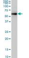 Cyclin Dependent Kinase 8 antibody, H00001024-M03, Novus Biologicals, Western Blot image 