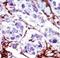 Cytidine/Uridine Monophosphate Kinase 1 antibody, LS-C101246, Lifespan Biosciences, Immunohistochemistry paraffin image 