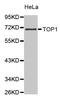 DNA topoisomerase 1 antibody, LS-C332692, Lifespan Biosciences, Western Blot image 