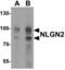 Neuroligin-2 antibody, PA5-72822, Invitrogen Antibodies, Western Blot image 