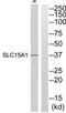 Solute Carrier Family 15 Member 1 antibody, TA314547, Origene, Western Blot image 