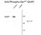 GluA1 antibody, GTX30221, GeneTex, Western Blot image 