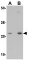 NSE2 (MMS21) Homolog, SMC5-SMC6 Complex SUMO Ligase antibody, GTX85185, GeneTex, Western Blot image 