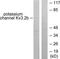 Potassium Voltage-Gated Channel Subfamily C Member 2 antibody, TA314124, Origene, Western Blot image 