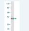 Vacuolar Protein Sorting 25 Homolog antibody, H00084313-M02, Novus Biologicals, Western Blot image 