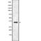 Uracil DNA Glycosylase antibody, abx219261, Abbexa, Western Blot image 