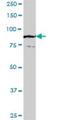Tetratricopeptide Repeat Domain 27 antibody, H00055622-B01P, Novus Biologicals, Western Blot image 