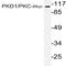 Protein Kinase D1 antibody, AP20992PU-N, Origene, Western Blot image 