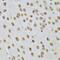 Integrin Linked Kinase antibody, FNab04289, FineTest, Immunohistochemistry paraffin image 