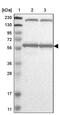 Karyopherin Subunit Alpha 6 antibody, PA5-53867, Invitrogen Antibodies, Western Blot image 