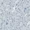 Solute Carrier Family 27 Member 5 antibody, NBP2-52881, Novus Biologicals, Immunohistochemistry paraffin image 